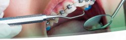 Aperfeiçoamento em Ortodontia - 001 - O_M